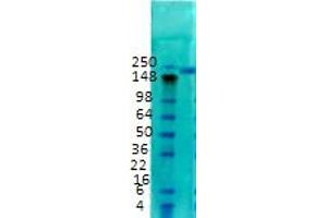 Western Blotting (WB) image for anti-Sodium Channel, Voltage-Gated, Type II, alpha Subunit (SCN2A) (C-Term) antibody (ABIN6658123)