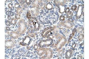 Immunohistochemistry (IHC) image for anti-Uronyl-2-Sulfotransferase (UST) (C-Term) antibody (ABIN2782688) (UST 抗体  (C-Term))