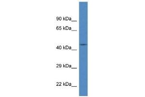 Western Blot showing FBXL20 antibody used at a concentration of 1 ug/ml against Fetal Brain Lysate