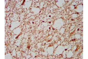IHC image of ABIN7155757 diluted at 1:600 and staining in paraffin-embedded human brain tissue performed on a Leica BondTM system. (HOXD1 抗体  (AA 59-131))