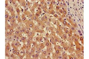 Immunohistochemistry of paraffin-embedded human liver tissue using ABIN7143681 at dilution of 1:100 (AOX1 抗体  (AA 236-421))
