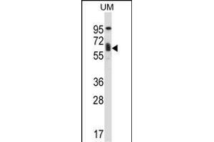 TCF3 Antibody (C-term) (ABIN657912 and ABIN2846860) western blot analysis in human uterine tumor tissue lysates (35 μg/lane). (TCF3 抗体  (C-Term))