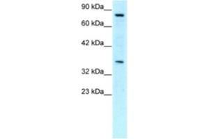 Western Blotting (WB) image for anti-Neuronal PAS Domain Protein 1 (NPAS1) antibody (ABIN2460366) (NPAS1 抗体)