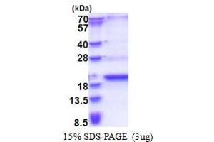SCP2 Sterol-Binding Domain Containing 1 (SCP2D1) (AA 1-156) protein (His tag)
