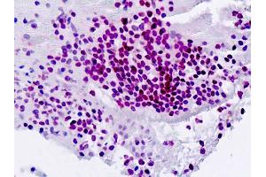 Immunohistochemistry (IHC) image for anti-Spleen Focus Forming Virus (SFFV) Proviral Integration Oncogene Spi1 (SPI1) (AA 217-246) antibody (ABIN1804568)