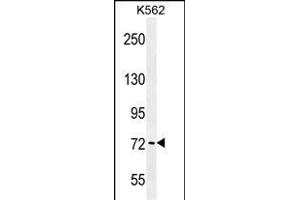 Western Blotting (WB) image for anti-P21-Activated Kinase 6 (PAK6) (AA 268-297) antibody (ABIN656098)