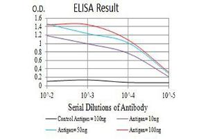 Black line: Control Antigen (100 ng),Purple line: Antigen (10 ng), Blue line: Antigen (50 ng), Red line:Antigen (100 ng) (CCR1 抗体)