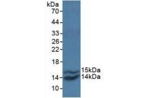 Detection of Recombinant MCP1, Simian using Polyclonal Antibody to Monocyte Chemotactic Protein 1 (MCP1) (CCL2 抗体  (AA 24-99))