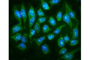 IF analysis of P38 Gamma/MAPK12 using anti-P38 Gamma/MAPK12 antibody (ABIN7600727). (MAPK12 抗体  (AA 229-367))