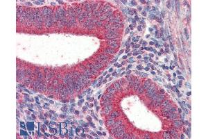 Immunohistochemistry (IHC) image for anti-Tripartite Motif Containing 5 (TRIM5) (N-Term) antibody (ABIN184983)