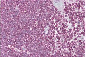Immunohistochemistry (IHC) image for anti-CD40 Ligand (CD40LG) (Middle Region) antibody (ABIN2778145)