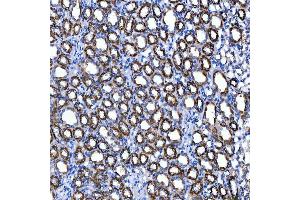 IHC analysis of SUCLG2 using anti-SUCLG2 antibody (ABIN7601694).