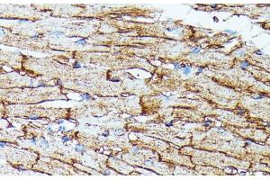 Immunohistochemistry of paraffin-embedded Mouse heart using SLC14A1 Polyclonal Antibody at dilution of 1:100 (40x lens). (SLC14A1 抗体)