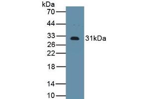 Detection of Recombinant IL2Ra, Mouse using Polyclonal Antibody to Interleukin 2 Receptor Alpha (IL2Ra) (CD25 抗体  (AA 22-235))
