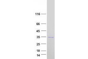 Western Blotting (WB) image for Synaptonemal Complex Protein 3 (SYCP3) protein (Myc-DYKDDDDK Tag) (ABIN2733032)