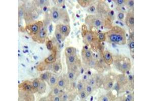 Used in DAB staining on fromalin fixed paraffin-embedded Liver tissue (DISC1 抗体  (AA 151-340))