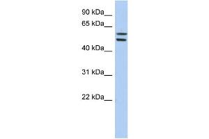 WB Suggested Anti-ZNF513 Antibody Titration:  0.