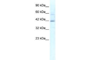 WB Suggested Anti-KCTD10 Antibody Titration:  1. (KCTD10 抗体  (N-Term))