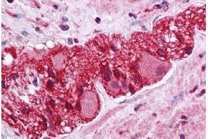 Human Colon, Myenteric Plexus: Formalin-Fixed, Paraffin-Embedded (FFPE) (LMBRD1 抗体  (C-Term))