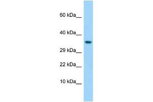 Western Blotting (WB) image for anti-Taste Receptor, Type 1, Member 1 (TAS1R1) (C-Term) antibody (ABIN2790236) (TAS1R1 抗体  (C-Term))