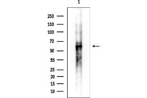 Western blot analysis of lysates from COLO205 cells, using Phospho-p62Dok (Tyr362) Antibody at 1/1000 dilution.