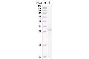 Western blot analysis using HER-2 mouse mAb against truncated HER-2 recombinant protein. (ErbB2/Her2 抗体)