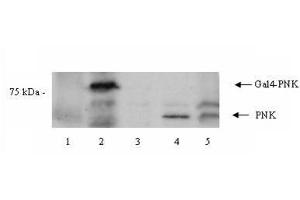 Western blot using  Affinity Purified anti-PNK antibody shows detection of a 57 kDa band corresponding to human PNK in a Y190 yeast cell lysate (lane 1), Y190 yeast cell lysate + human PNK (Gal DNA BP) (lane 2), EM9 XH Chinese hamster ovary cell lysate (lane 3), EM9 XH Chinese hamster ovary cell lysate + human PNK (lane 4) and a HeLa cell lysate (lane 5). (PNKP 抗体  (Internal Region))