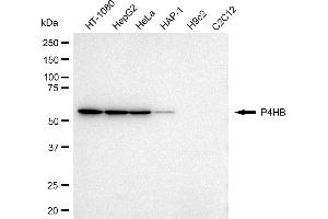 Western blotting analysis using P4HB antibody (ABIN7799919). (P4HB 抗体)