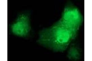 Image no. 1 for anti-Catenin (Cadherin-Associated Protein), beta 1, 88kDa (CTNNB1) antibody (ABIN1496891) (CTNNB1 抗体)