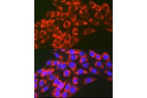 Immunofluorescence analysis of NIH-3T3 cells using TFEB Rabbit pAb (ABIN6128819, ABIN6149043, ABIN6149045 and ABIN6223149) at dilution of 1:100 (40x lens). (TFEB 抗体)