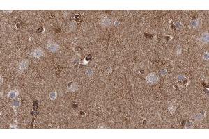 ABIN6272633 at 1/100 staining Human brain cancer tissue by IHC-P. (GABARAPL2 抗体  (N-Term))