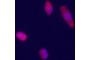 Immunofluorecence staining of Glypican 3 antibody on HepG2 cells. (Glypican 3 抗体  (AA 335-365))