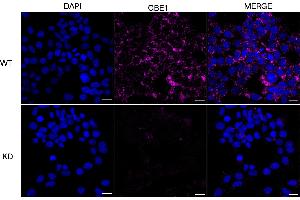 anti-Glucan (1,4-alpha-), Branching Enzyme 1 (GBE1) antibody