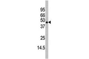 Western blot analysis of MAPK11 antibody and mouse heart tissue lysate (MAPK11 抗体  (AA 334-359))