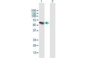 Western Blot analysis of C1RL expression in transfected 293T cell line by C1RL MaxPab polyclonal antibody. (C1RL 抗体  (AA 1-487))