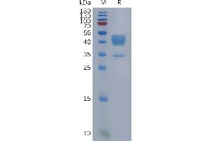 SDS-PAGE (SDS) image for Complement Component 5a Receptor 1 (C5AR1) (AA 1-37) protein (Fc Tag) (ABIN6964150)