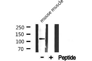 Western Blotting (WB) image for anti-Collagen, Type I, alpha 2 (COL1A2) (N-Term) antibody (ABIN6258438)