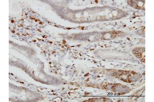 Immunoperoxidase of monoclonal antibody to CDH18 on formalin-fixed paraffin-embedded human small Intestine. (CDH18 抗体  (AA 467-576))