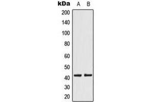 Western blot analysis of KCNK15 expression in JEG3 (A), HeLa (B) whole cell lysates. (KCNK15 抗体  (C-Term))