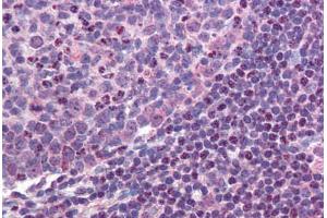 Colon, lymphoid follicle (MALT1 抗体  (AA 43-57))