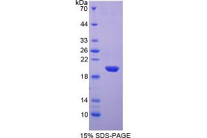 Image no. 1 for Superoxide Dismutase 1, Soluble (SOD1) (AA 2-152) protein (His tag) (ABIN6238043) (SOD1 Protein (AA 2-152) (His tag))