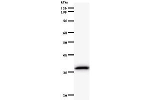 Western Blotting (WB) image for anti-Endonuclease 8-like 2 (NEIL2) antibody (ABIN933141) (NEIL2 抗体)