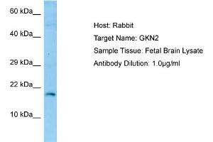 Western Blotting (WB) image for anti-Gastrokine 2 (GKN2) (N-Term) antibody (ABIN2790149) (Gastrokine 2 抗体  (N-Term))