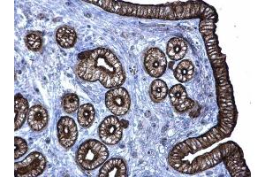 IHC-P Image Cytokeratin 6 antibody detects Cytokeratin 6 protein at membrane on mouse cervix by immunohistochemical analysis. (KRT6A 抗体)