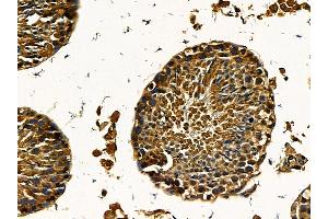 ABIN7095560 and ABIN7099617 at 1/100 staining mouse testis tissue by IHC-P. (ARPIN 抗体)