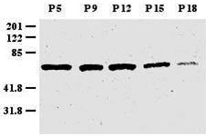 Anti-Zic1 Antibody - Western Blot. (ZIC1 抗体  (N-Term))