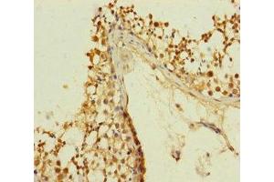 Immunohistochemistry of paraffin-embedded human testis tissue using ABIN7147376 at dilution of 1:100 (PLK1S1 抗体  (AA 1-240))