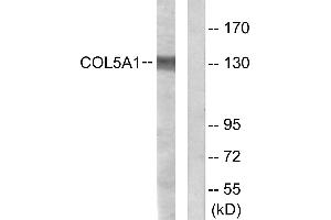 Immunohistochemistry analysis of paraffin-embedded human heart tissue using Collagen V α1 antibody. (COL5A1 抗体)
