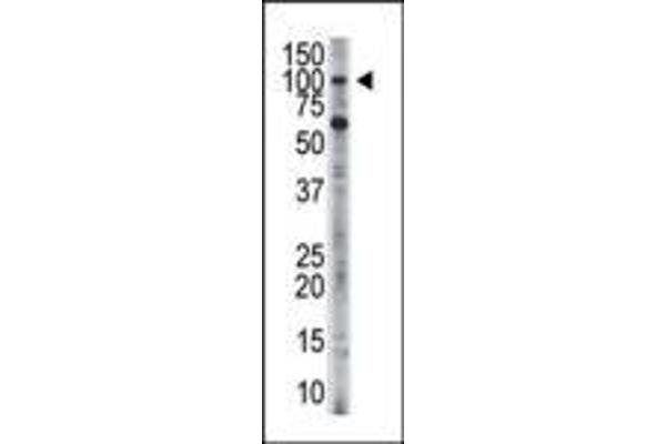 HK3 抗体  (C-Term)