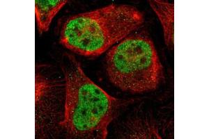 Immunofluorescent staining of U-2 OS with MEF2D polyclonal antibody  (Green) shows positivity in nucleus but excluded from the nucleoli. (MEF2D 抗体)
